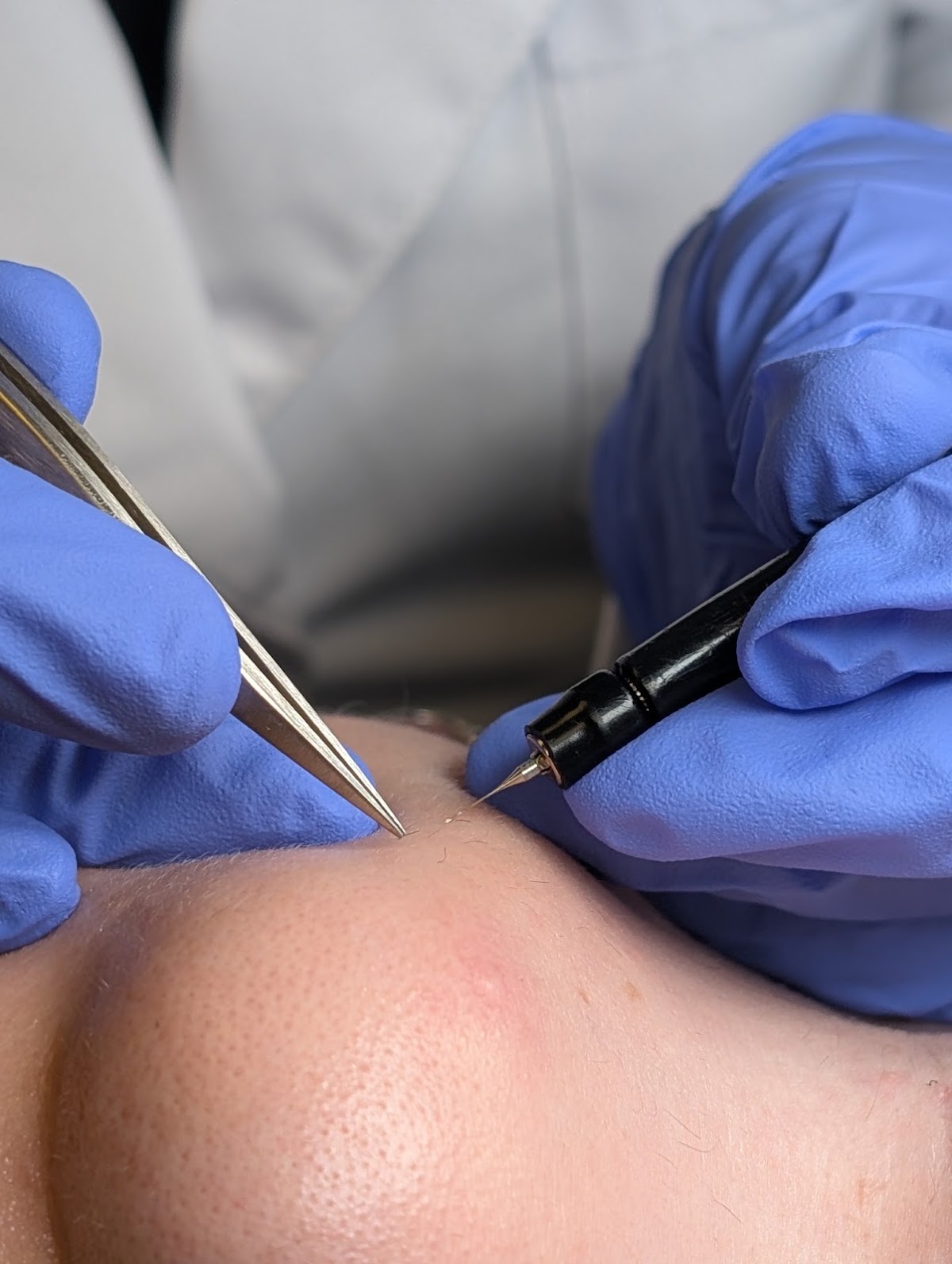 Nurtured Soul Wellness: Electrolysis and Esthetics