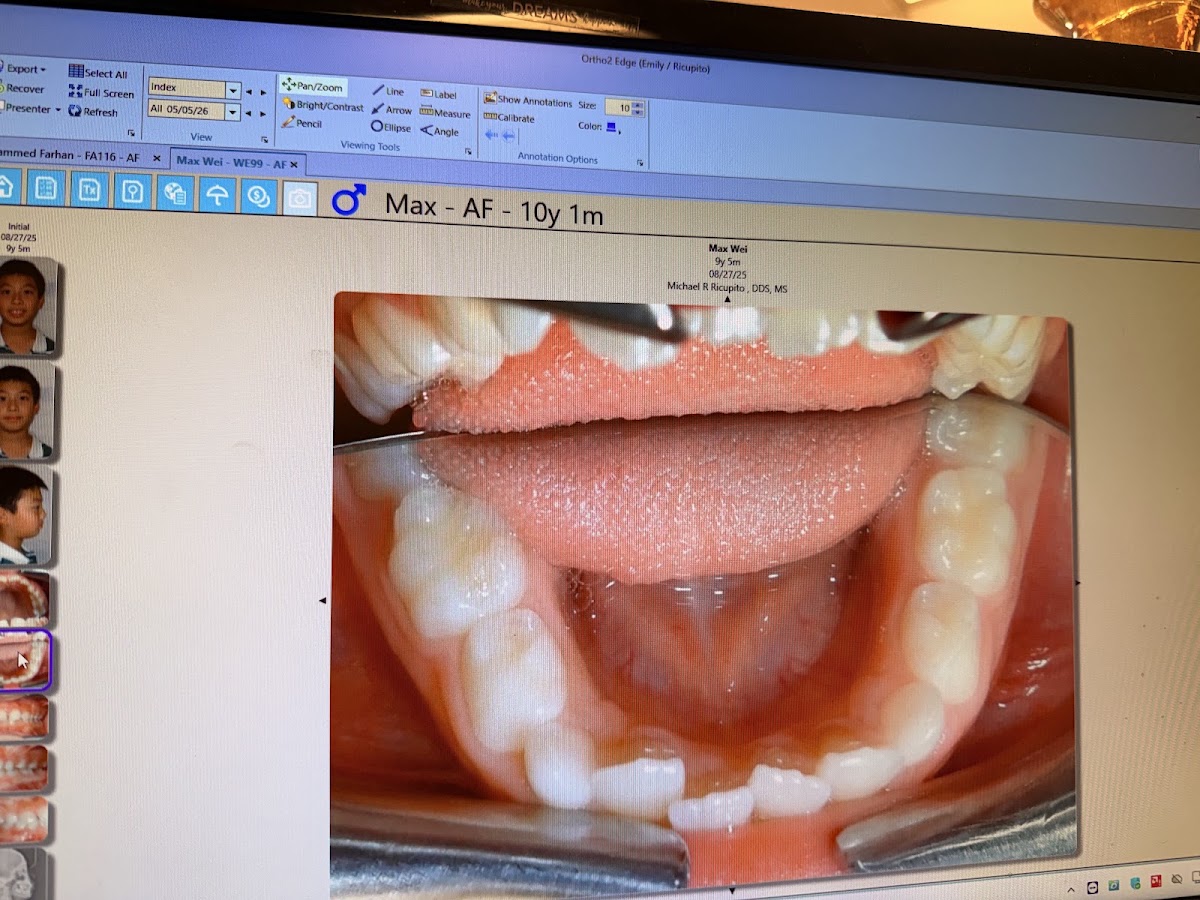 Mission Hills Orthodontics-Michael R. Ricupito, DDS, MS