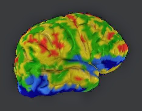 Alzheimer's Imaging Center