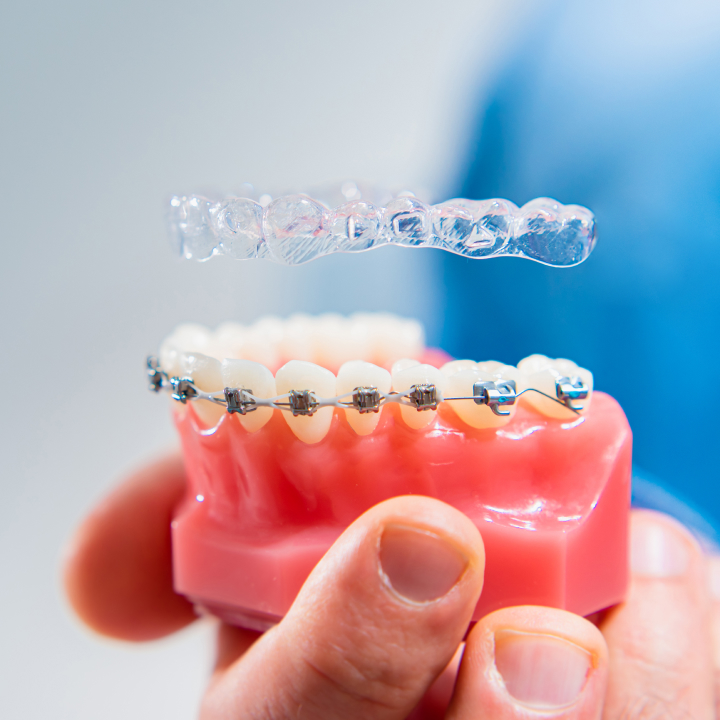 East Bay Dental - Dental Implants, Orthodontist Dentist