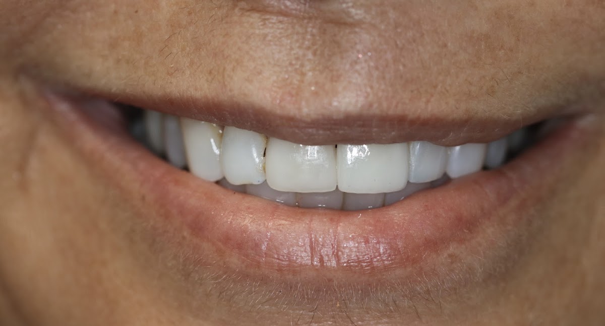 Legacy Dental Studio — General Dentist in Antioch, CA (photo 2 of 3)