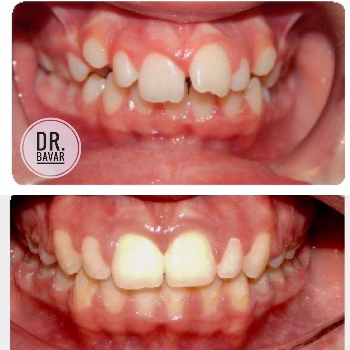 $99 exam and cleaning at Toothworks of Bakersfield
