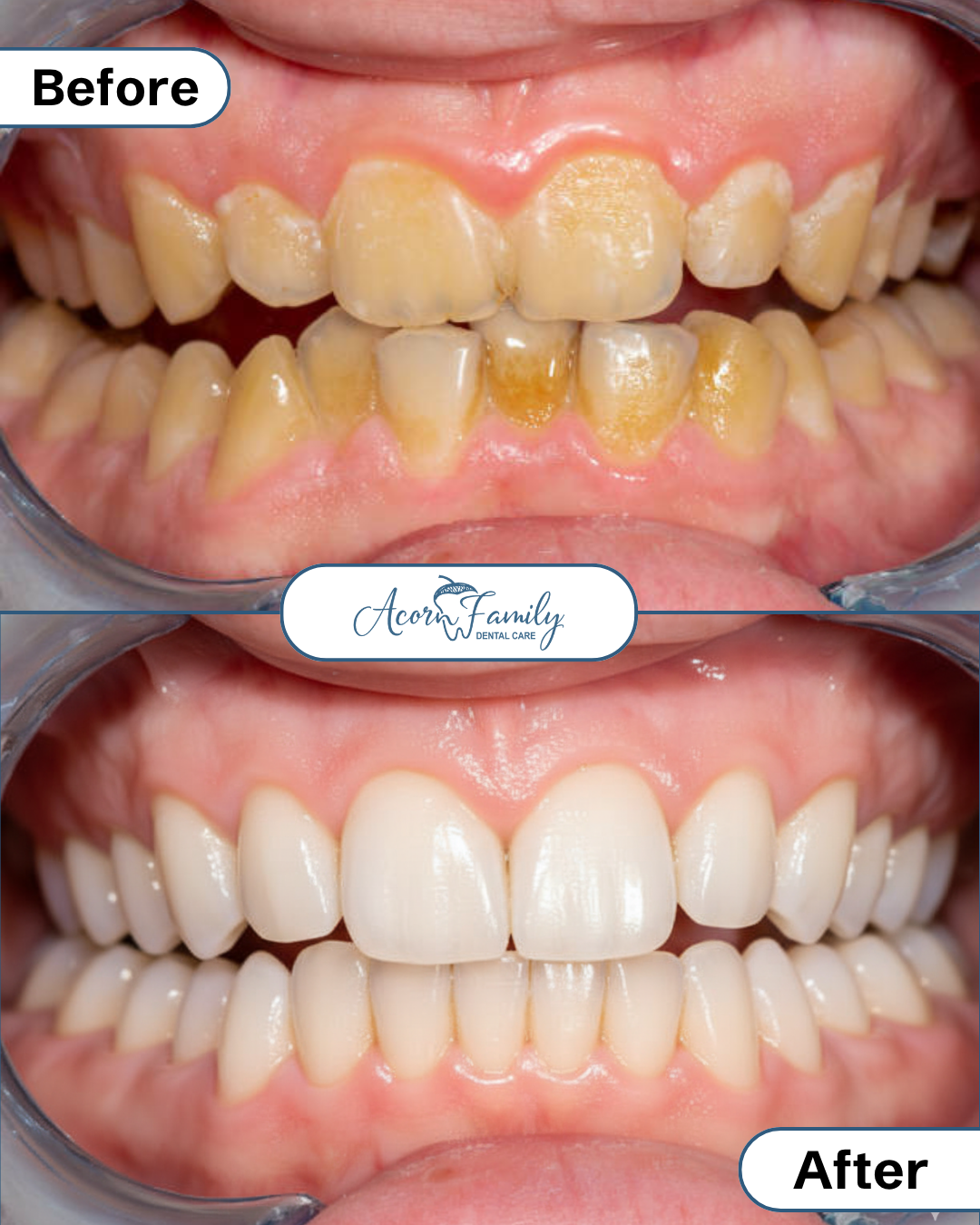 Acorn Family Dental Care — General Dentist in Berkeley, CA (photo 2 of 3)
