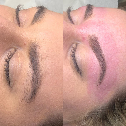 Bare Beauty Bar — Dermatologist in Danville, CA