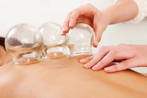Bay Area Acupuncture — Acupuncturist in Danville, CA