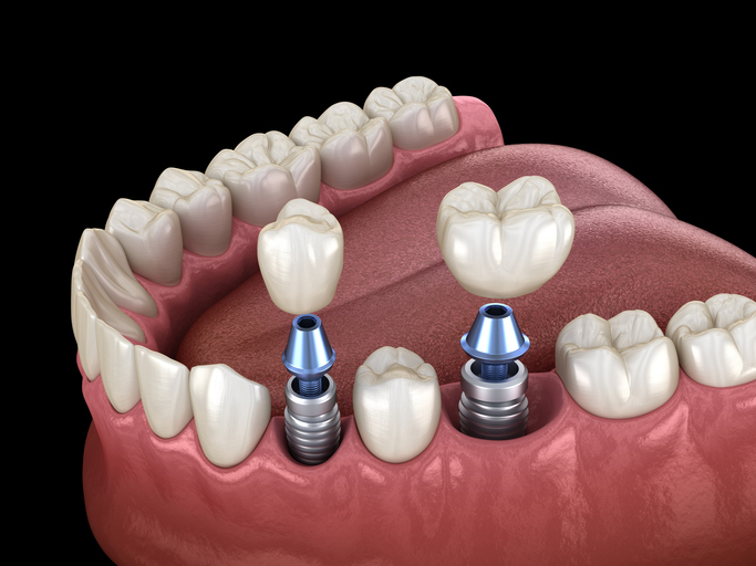 South Bay Dentistry & Orthodontics — in Gardena, CA (photo 2 of 2)
