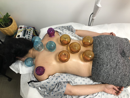 Lotus Valley Acupuncture — Acupuncturist in Milpitas, CA