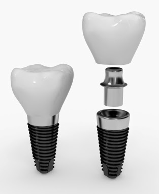 Tice Valley Dental — General Dentist in Walnut Creek, CA (photo 3 of 3)